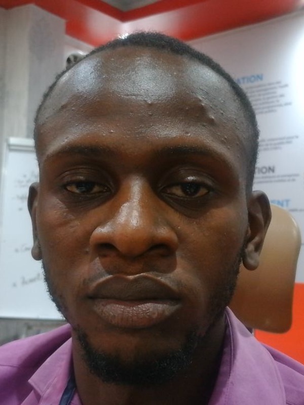 BUNTELA PASCAL Eraste